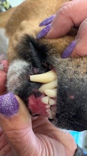 Dental disease