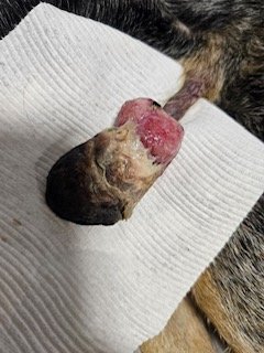 Tumor removal