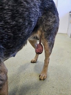 Tumor removal