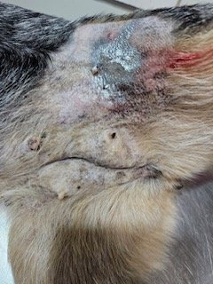 Tumor removal