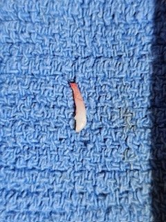 Baby tooth removal