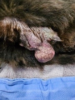 Tumor removal before, and the physical mass.